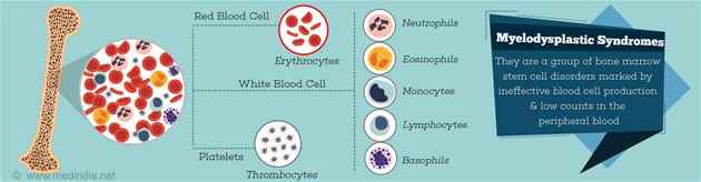 Best doctors for Myelodysplastic Syndrome in Delhi NCR India